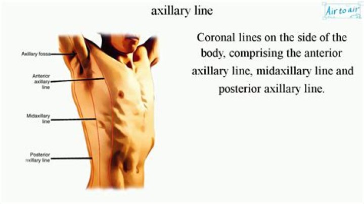 What does the medical term axillary mean?