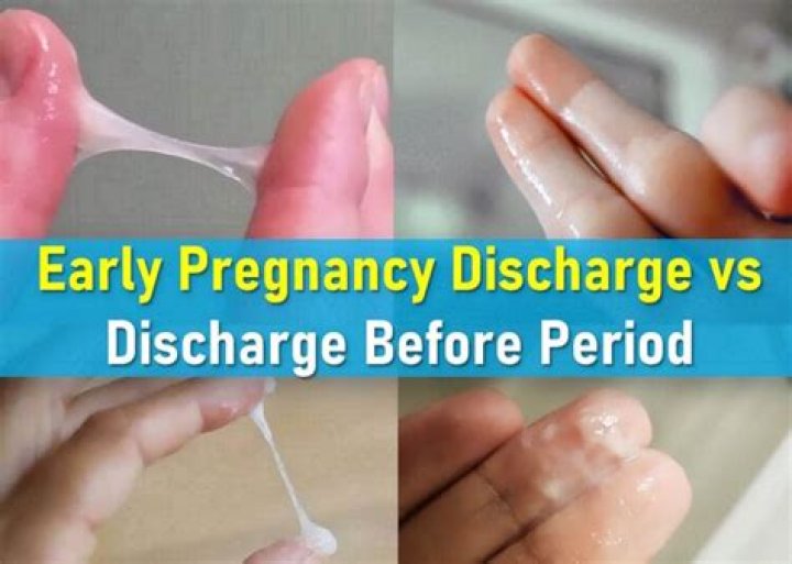 What does tissue discharge look like pregnancy?
