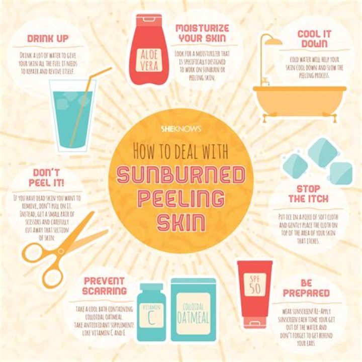 What helps raw skin after sunburn peeling?