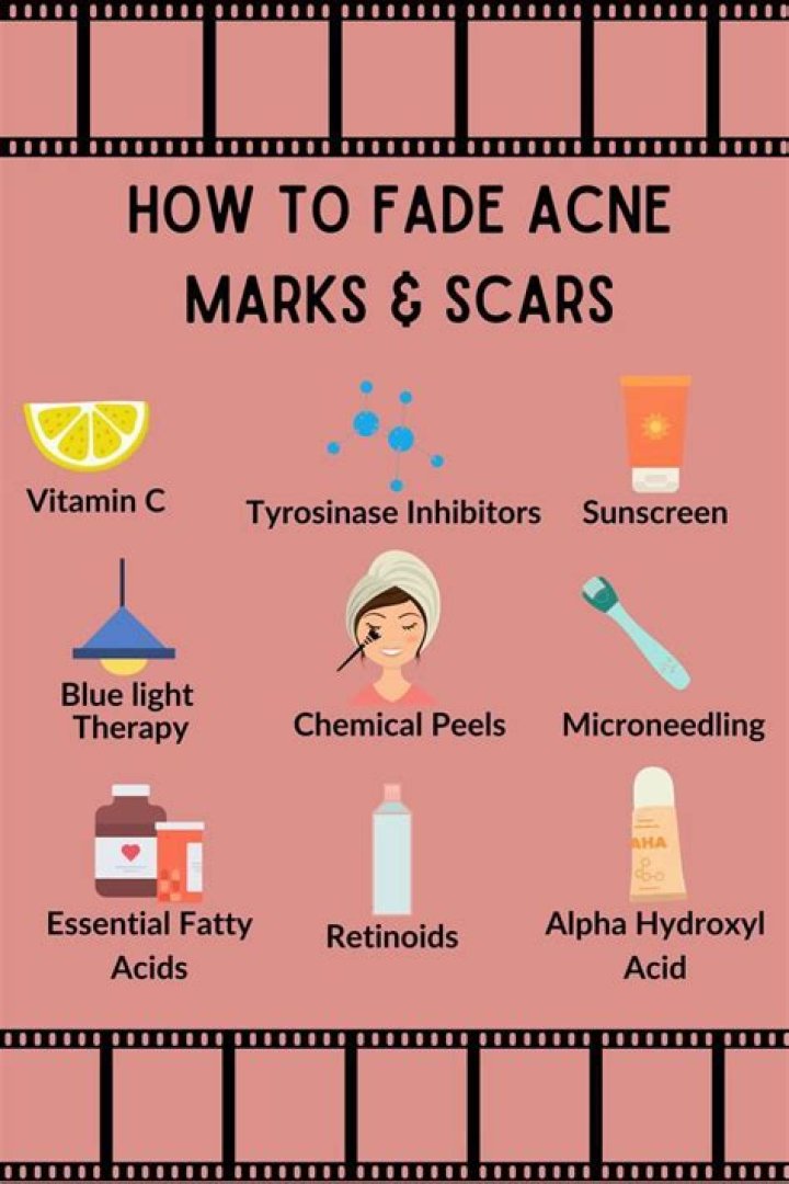 What ingredients help fade acne scars?