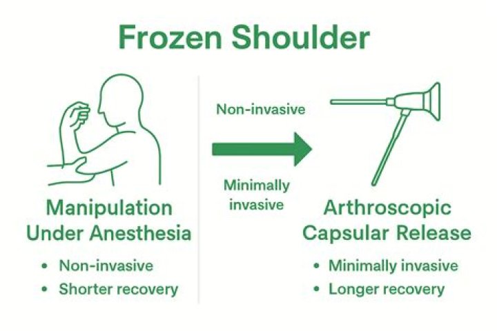What is a Frozen Partition?