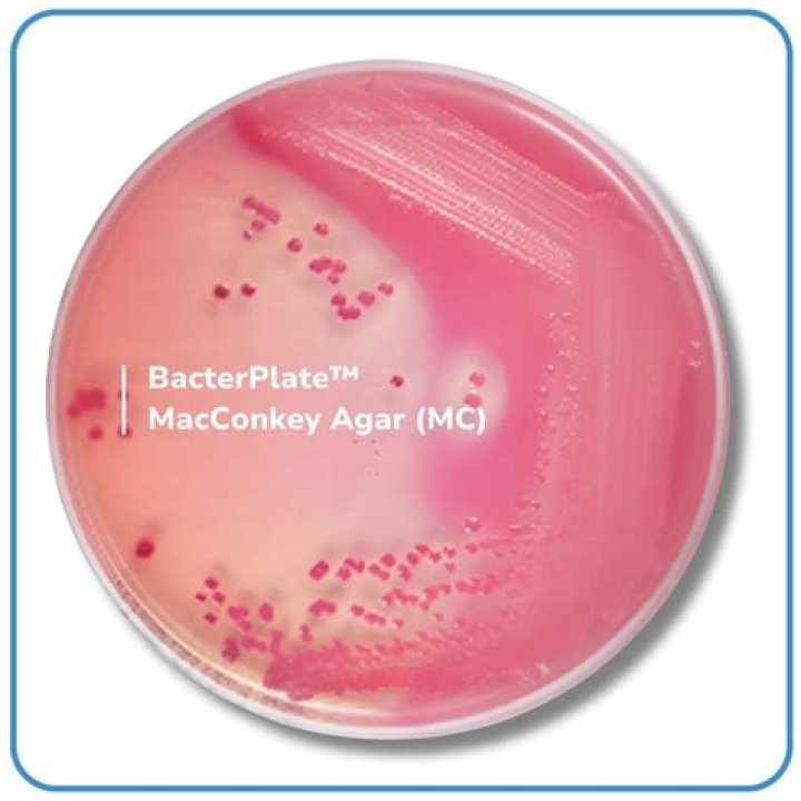 What is a MacConkey agar plate used for?