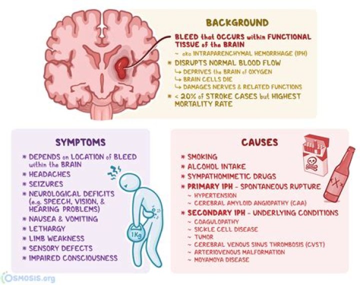 What is a parenchymal hematoma?