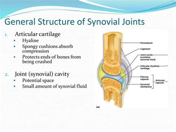 What is a synovial proliferation?