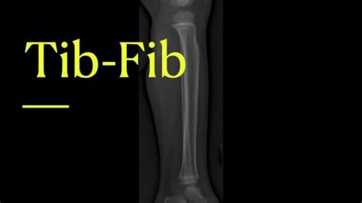 What is a tib fib xray?