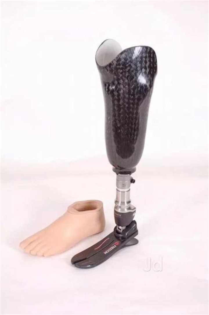 What is a transtibial prosthesis?