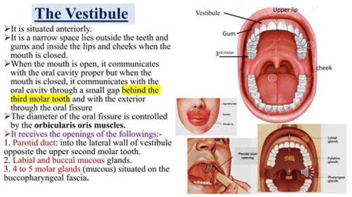 What is a vestibule in teeth?