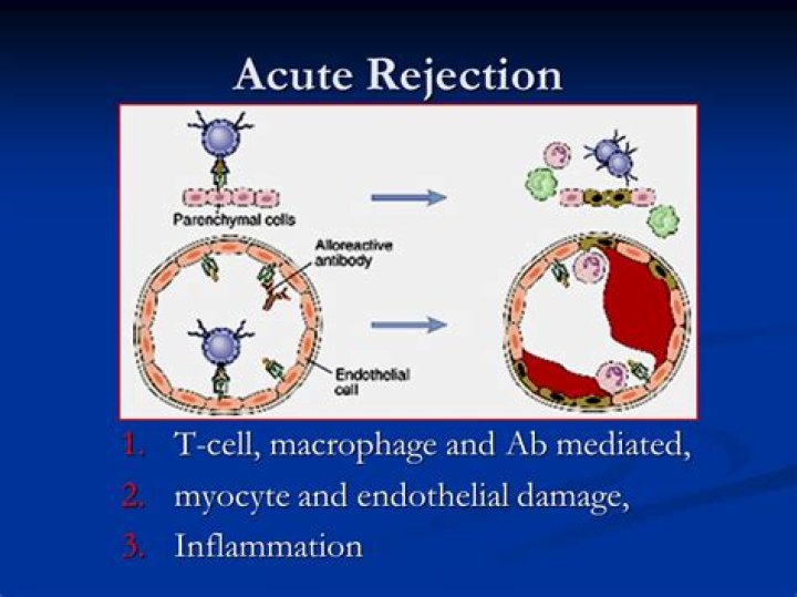 What is acute cellular rejection?