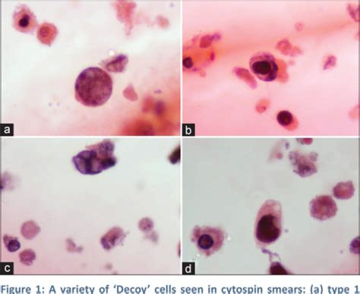 What is Decoy cells?