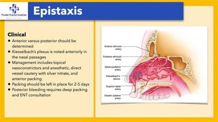 What is Epitaxis?
