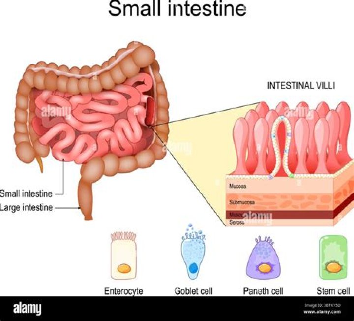 What is intestinal duplication?