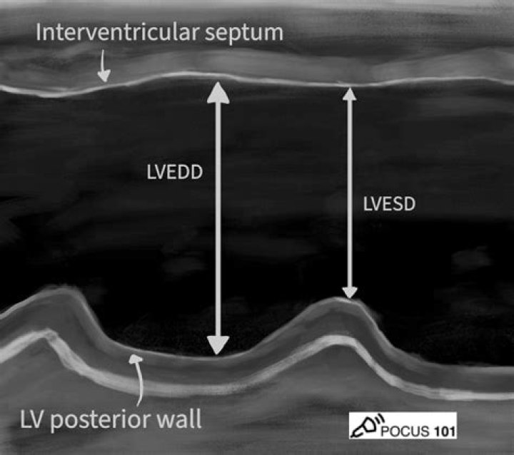 What is LVED in Echo?