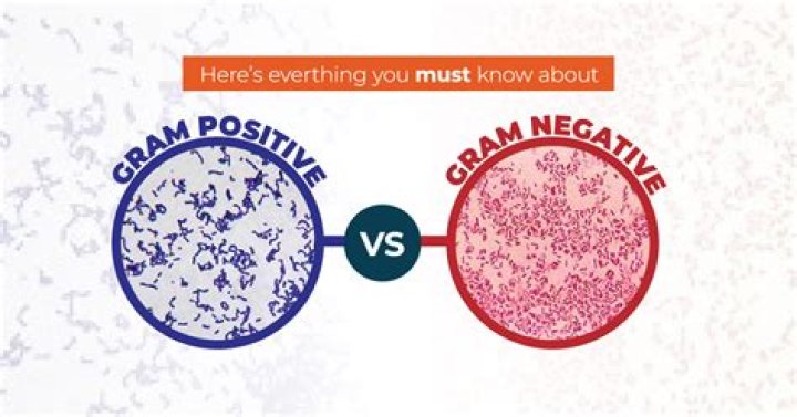 What is negative g factor?