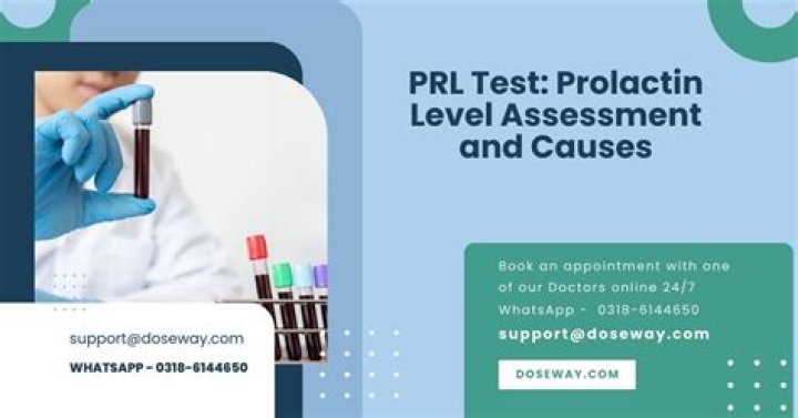 What is PRL test normal range?