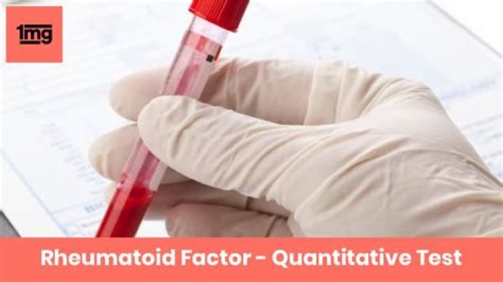 What is RF Quant test?