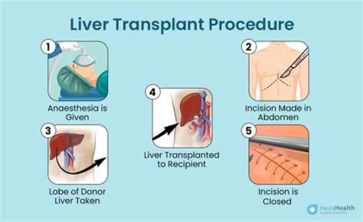 What is the average waiting time for a liver transplant?
