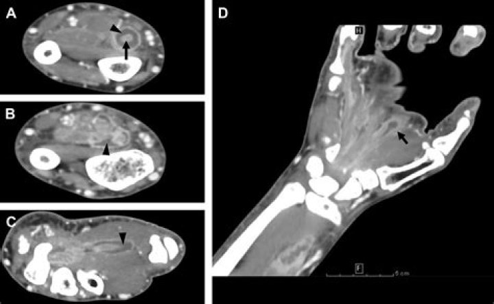 What is the best imaging for soft tissue?
