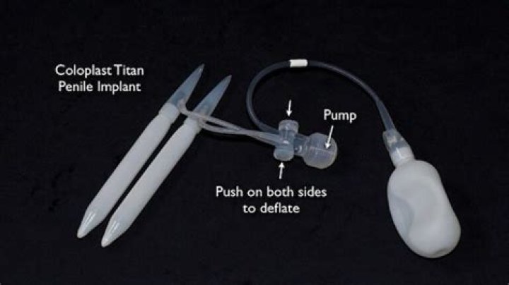 What is the largest penile implant?