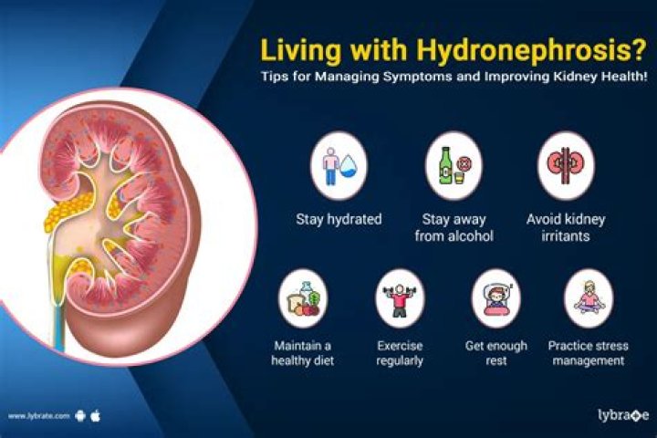 What is the main cause of hydronephrosis?