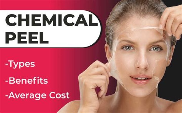 What is the most effective chemical peel?