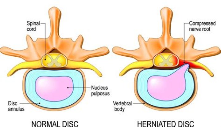 What is the name of the disc for long distance?