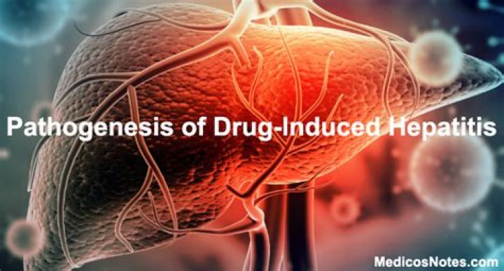 What is the pathophysiology of drug-induced hepatitis?