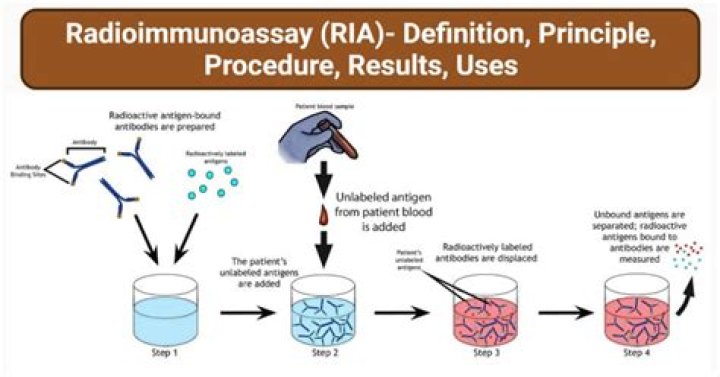 What is the principle of radioimmunoassay?