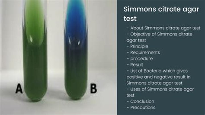 What is the purpose of Simmons citrate agar explain how it works?