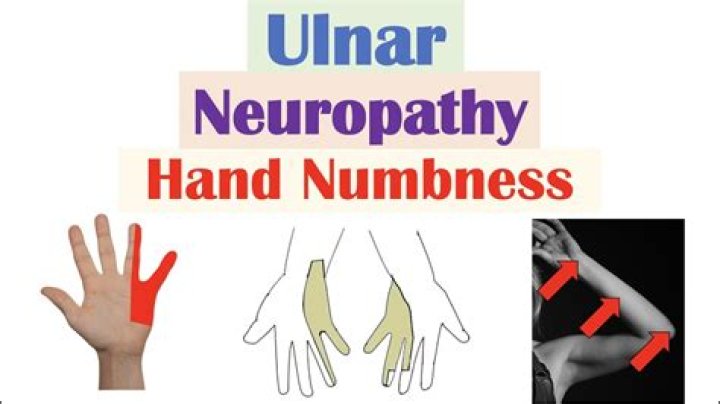 What is the reason for numbness in hands and legs?