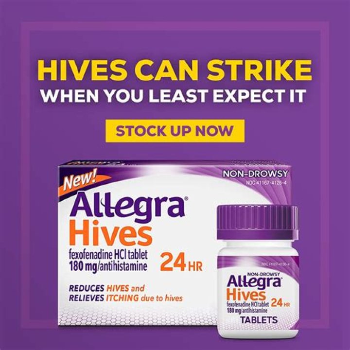 What is the strongest medication for hives?