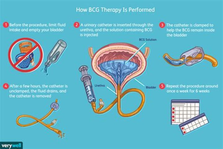 What is the success rate of BCG treatment for bladder cancer?