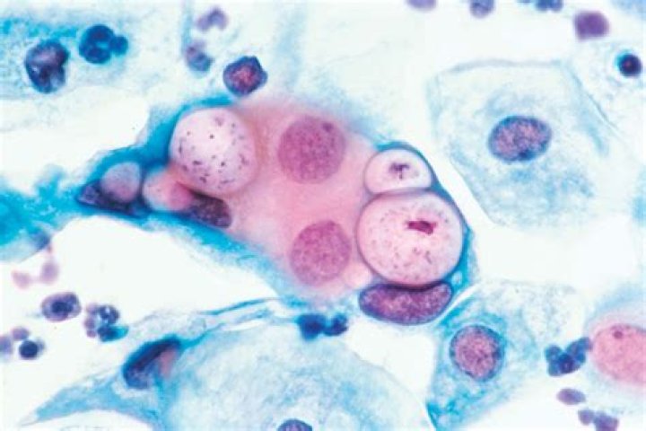 What shape bacteria is chlamydia?