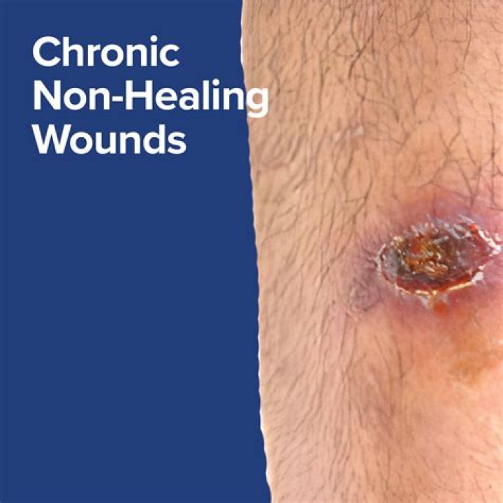 What to do if wound is not healing?