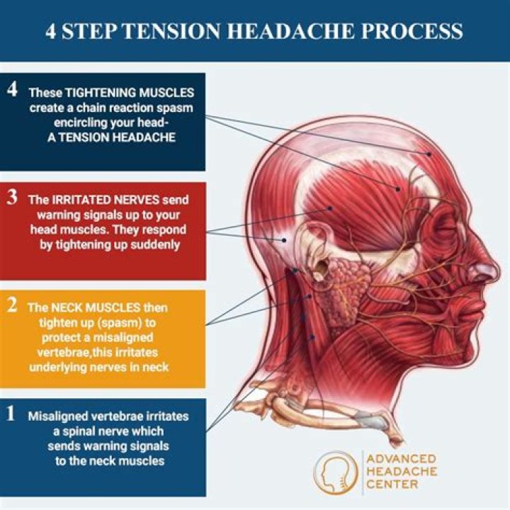 What type of headache is associated with hypertension?