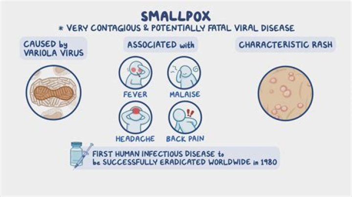 Which disease is caused by pox virus?